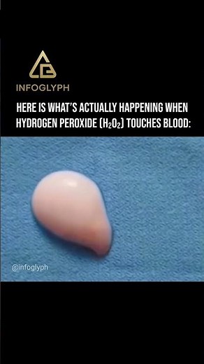 What’s actually happening when Hydrogen Peroxide (H₂O₂) touches blood #peroxide