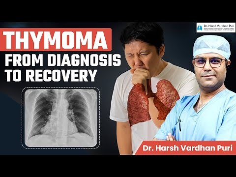 Thymoma Diagnosis, Symptoms, Treatment & Recovery | Robotic or VATS Technique Dr. Harsh Vardhan Puri