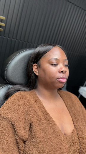 Achieve Facial Harmony with Expert Botox Techniques