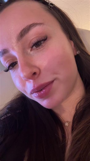 #foryou #cutieee #teen #softgirl #braces | girl with braces