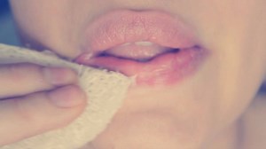 Amazing results with our lip combo for dried lips