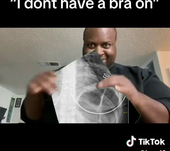 Understanding Chest X-rays: Insights from Radiology Techs and Why 'I Don't Have a Bra On' Matters