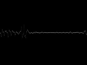 Table 2.1: Some Common Human Diseases caused by Mleroorganiams ... | Filo