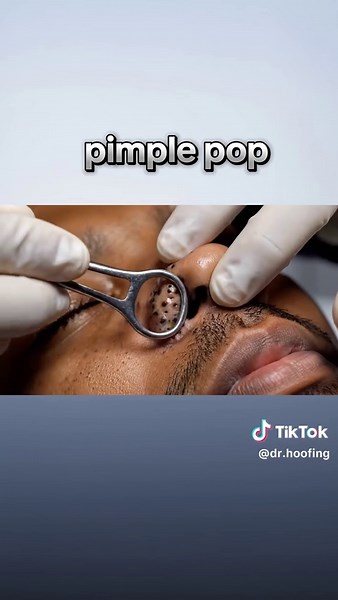 pimple pop 🤯 #satisfying #asmr #tik_tok #pimplepoper #viralvideos