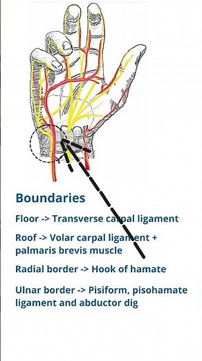 Guyon's Canal Anatomy | Ulnar Tunnel