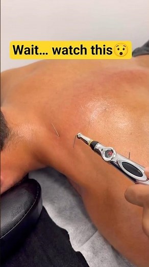 👉 If Your Muscle Twitches Like This… It’s Actually Healing 😳