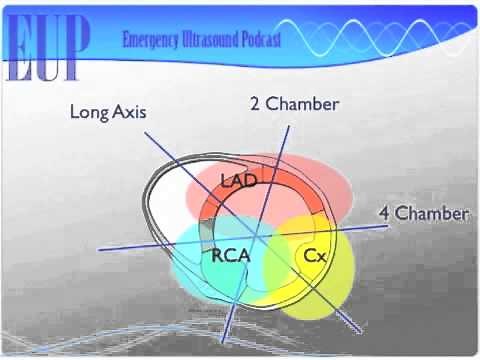 Ultrasound Podcast - WALL MOTION
