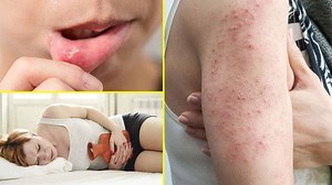 8 Signs You Have a Wheat Intolerance