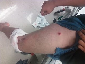 Original Upload, I Just Shot Myself!