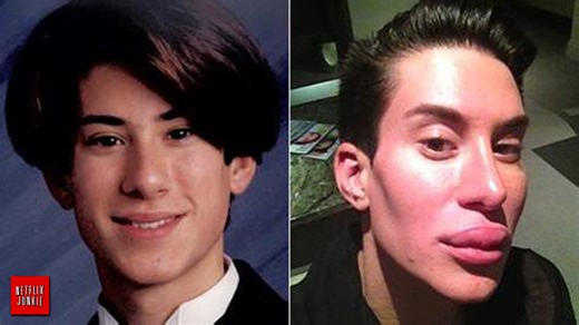 These male celebrities learned the hard way that plastic surgery isn’t perfect