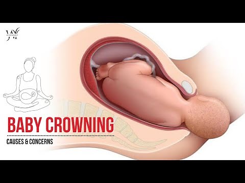 Baby Crowning - Everything you need to Know | New Mom - Normal Delivery Tips 🤰