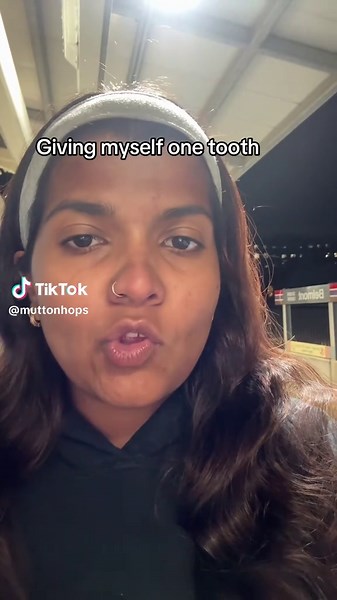 One Tooth Challenge: A Fun and Unique Experience
