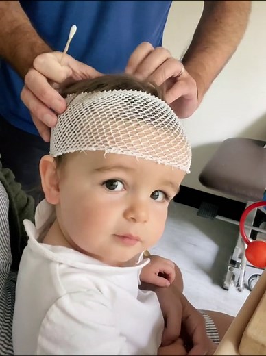 24 Hour EEG Monitoring for Baby: Live EEG Video
