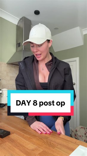 Day 8 Post-Op Hair Transplant Update