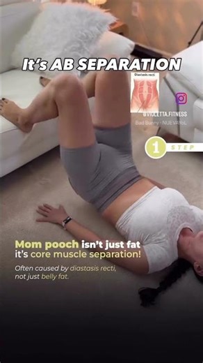 Ab Separation Recovery Plan - Follow this plan to restore abdominal wall strength step by step.