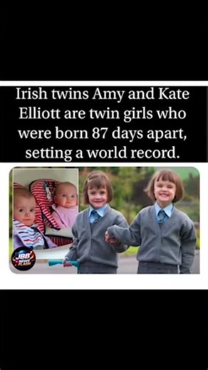 Meet the Irish twins who took “fashionably late” to a whole new level⏳👯‍♀️A true world record. 🌍📅