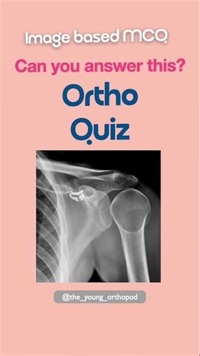 Light Bulb Sign on X-Ray 💡 | Can You Diagnose This? Ortho Radiology Quiz #NEETPG #medicalmcq #Ortho