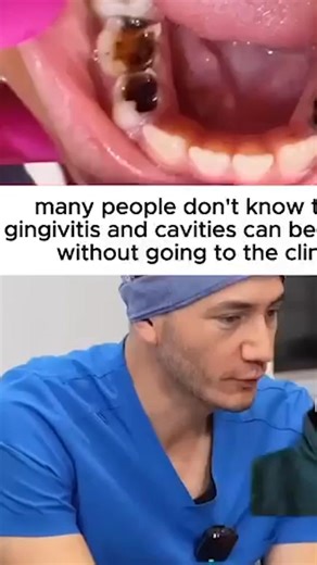 ❌ STOP scrubbing your teeth with chemicals that don’t fix anything Our fluoride-free Hydroxyapatite toothpaste uses the same mineral your teeth are made of — helping to rebuild enamel, repair micro-damage, and naturally whiten your smile. ✅ Strengthens enamel to fight cavities ✅ Freshens breath all day ✅ Gentle, safe, and fluoride-free Because oral care isn’t just about a bright smile — it’s about your health, your confidence, and feeling fresh every single day. 🔥Order now using the button belo