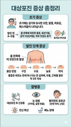 대상포진 증상 총정리