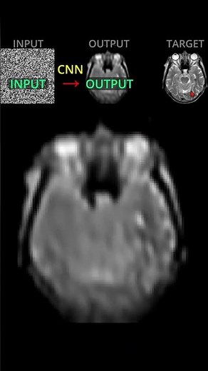 Visual Training of a CNN as a Denoiser (Deep Image Prior)
