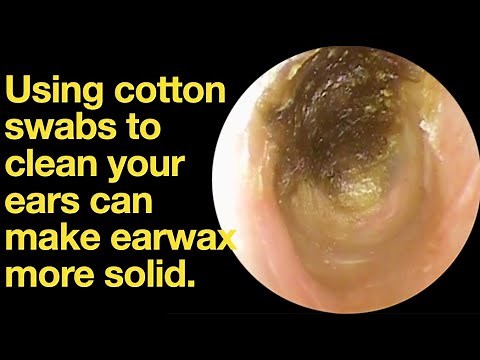 Using cotton swabs to clean your ears can make earwax more solid.|ear wax removal | ear cleaning