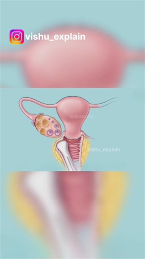 “क्या आप जानते हैं टेस्ट ट्यूब बेबी ऐसे बनते हैं? पूरा सच जानिए!”#IVF #TestTubeBaby #IVFTreatment