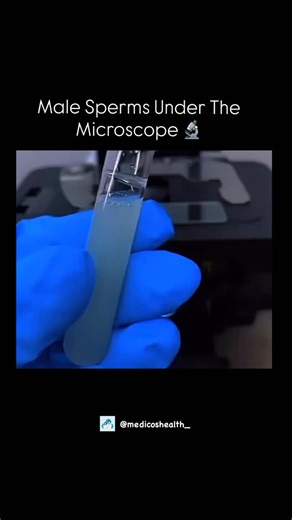 Medical & Health ⚕️ on Instagram: "Male Sperms Under The Microscope 🔬 . . . Dm for credit or removal 👏🏻 . . #viral #explore #biology #knowledge #science …"