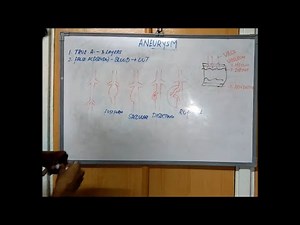 Aneurysm - Cerebral,Thoracic,Abdominal - Causes and Pathology