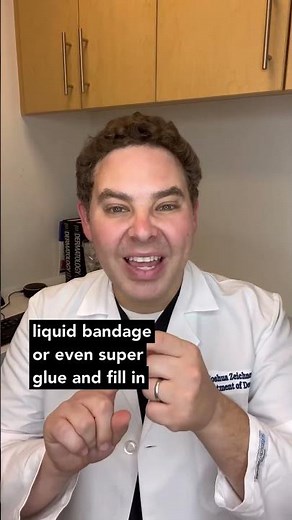 How to manage painful cracks in your fingers from dry skin. #skincare #health