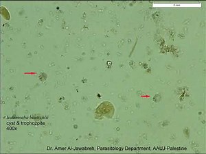 Iodamoeba bütschlii