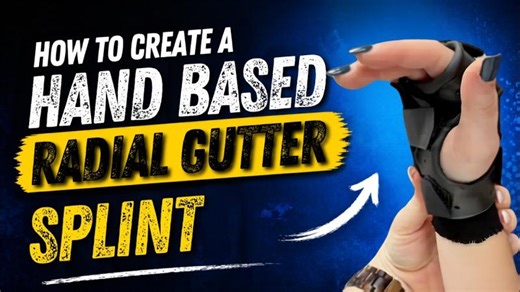 Radial Gutter Splint Fabrication Tutorial | Professional Seminars Ltd. posted on the topic | LinkedIn