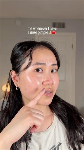 WHY is a nose pimple EXTRA bright red 😭🔴 #acneproneskin #skincare