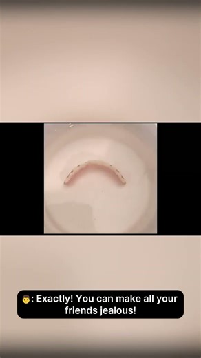 Thinking Just Veneers??? Instant Smile Upper and Lower Teeth Veneer