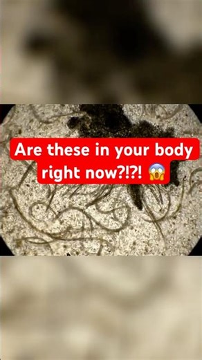 How Parasites Infect You: Shocking Facts!