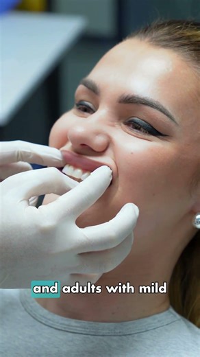 🦷 Invisible Aligners #alignersforteeth #alignerorthodontics #invisiblealigners #orthodontist