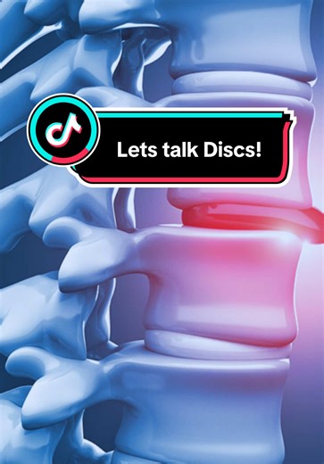 Let’s talk discs! #decompression #discherniation #chiropractor #fyp #chiropractortiktok