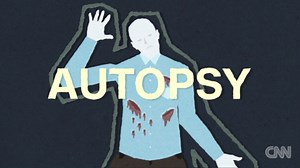 What happens during an autopsy? | CNN