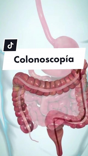 Todo sobre la colonoscopía: ¿Qué es y cómo se realiza?