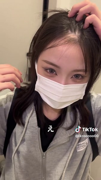 円形脱毛症とストレス解消の方法