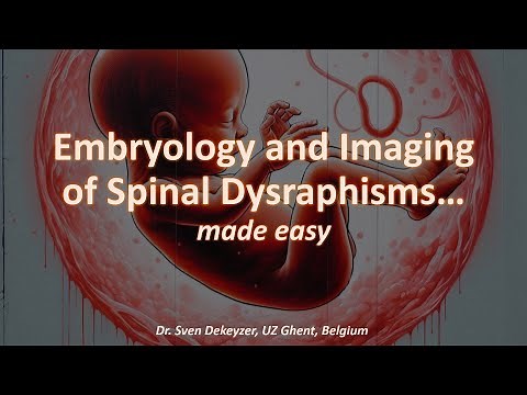 Pediatric Neuroradiology - Imaging of spinal dysraphisms... made easy