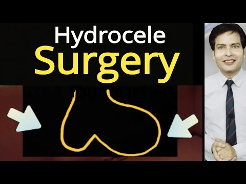 एक ka operation कराए या दोनों ka | One side or both side Hydrocele operation