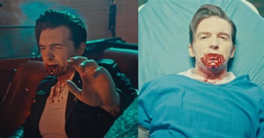 Drake Bell se inspira en accidente donde perdió 9 dientes para su nuevo video musical