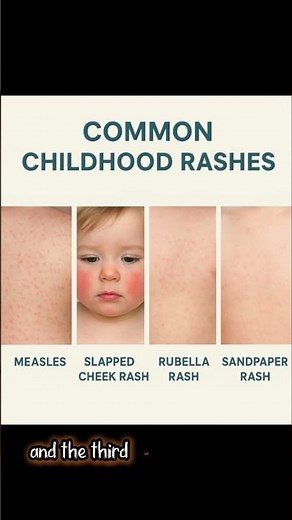 Pediatric Rashes: The MUST KNOW Visual Exam Guide!! #pediatrics #medshorts