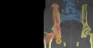 How to Use Split Mask in Mimics