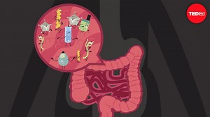 How the food you eat affects your gut