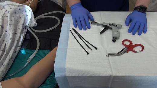 Zip Tie Chest Tube Securement