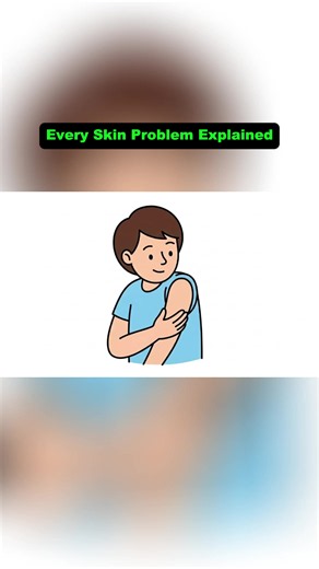 Every Major Skin Problem and Its Causes Explained (Moles) #moles #mole | moles
