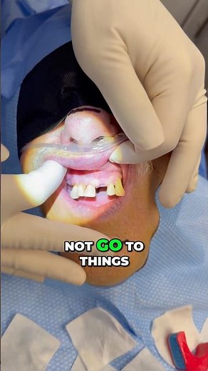 This Dental Implant Case is Incredible!
