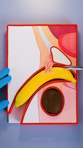 1.8M views · 2.8K reactions | The secrets behind medical procedures | 5-Minute Crafts | Facebook