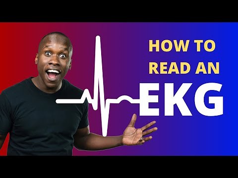 How to Read an EKG (Made Easy)